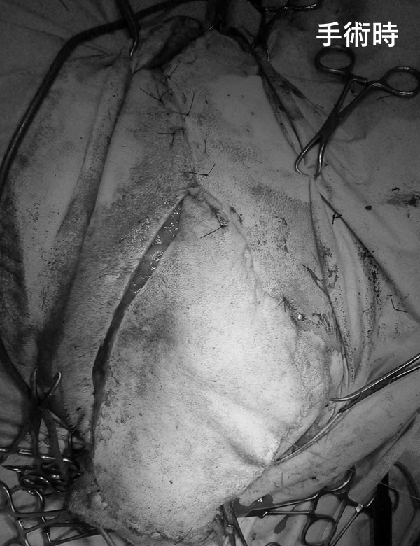 手術時