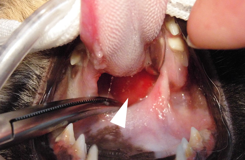 図：矢印が鼻咽頭ポリープ